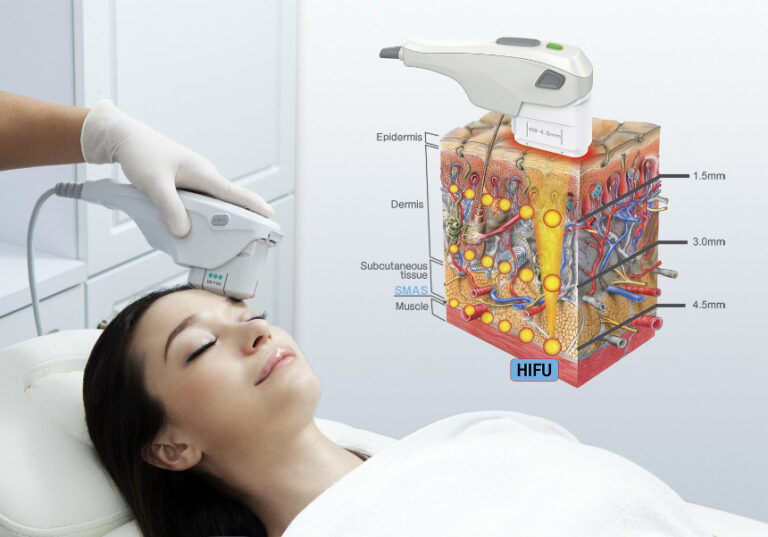 Ulthera vs Thermage: Complete Guide to Ulthermage Combination Lifting and Tightening in Korea